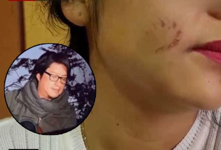 Músico del grupo antología mordió cara a su pareja